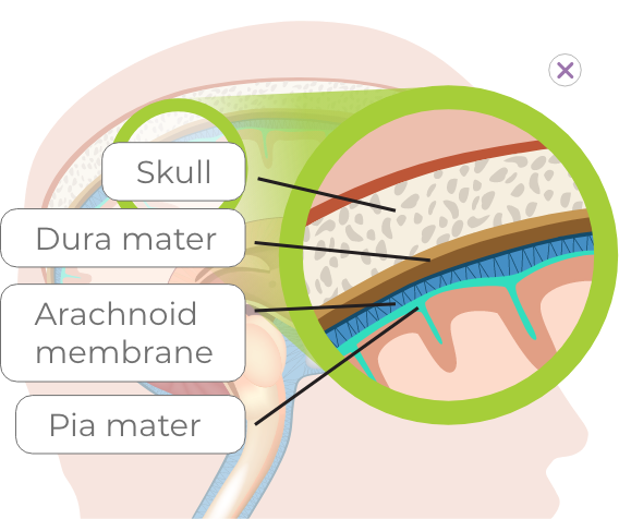 head with details